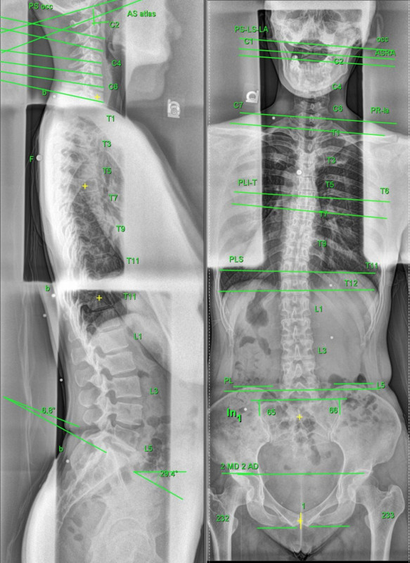 千駄ヶ谷, 北参道, 頭痛, 整体, 首こり, 肩こり, 小顔, 頭蓋骨調整, 女性専用